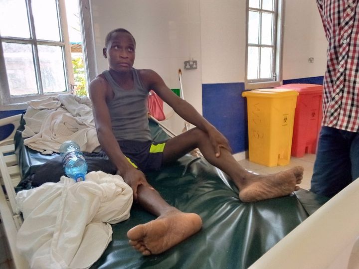 Machakos Mkokoteni pusher pleads for 60,000 to get a metal implant for his fractured leg