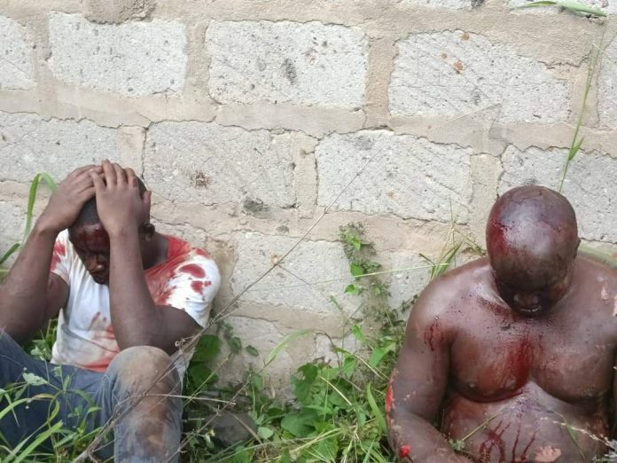 Two men caught stealing in Site, Kitui after being beaten by irate residents. (Photo - Kilonzo/ Mauvoo)