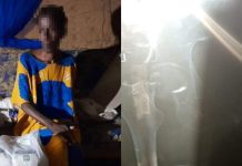 Woman left disabled after gang rape incident in Machakos to get help