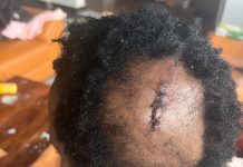 Sonko seeks justice for Masinga woman allegedly assaulted by police officer