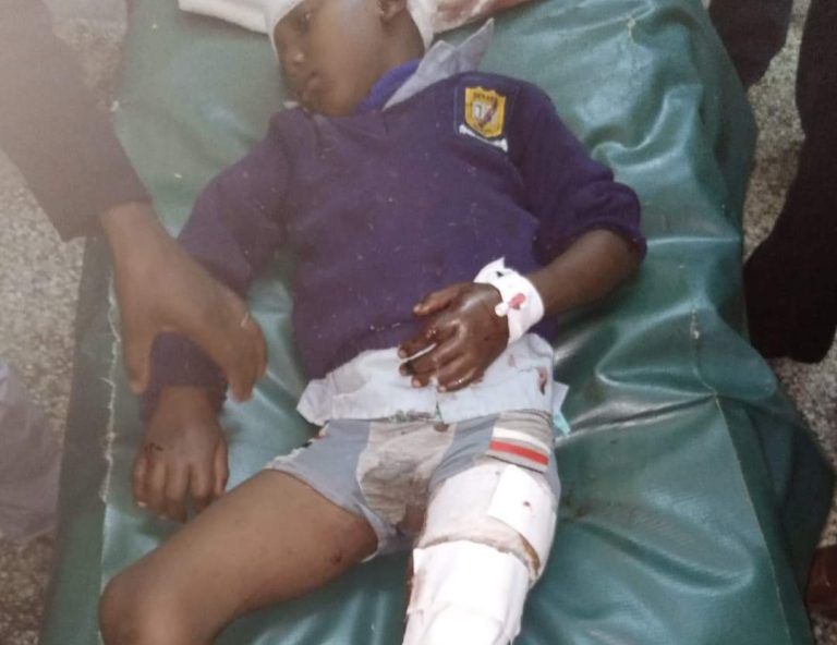 Mother of boy attacked by Hyena in Makueni narrates the ordeal